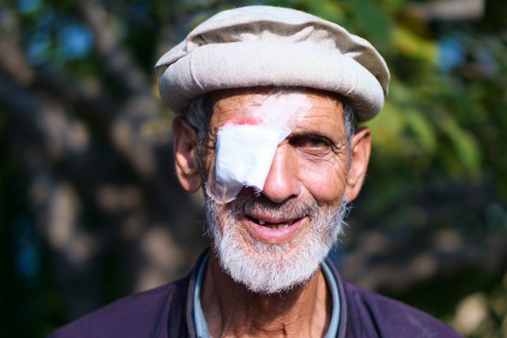 Sponsor a Cataract Surgery